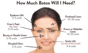 dermal filler vs botox Los Angeles