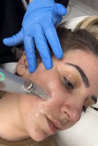 Microneedling & PRP vampire facial