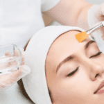 Chemical peel treatment