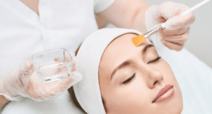 Chemical peel treatment