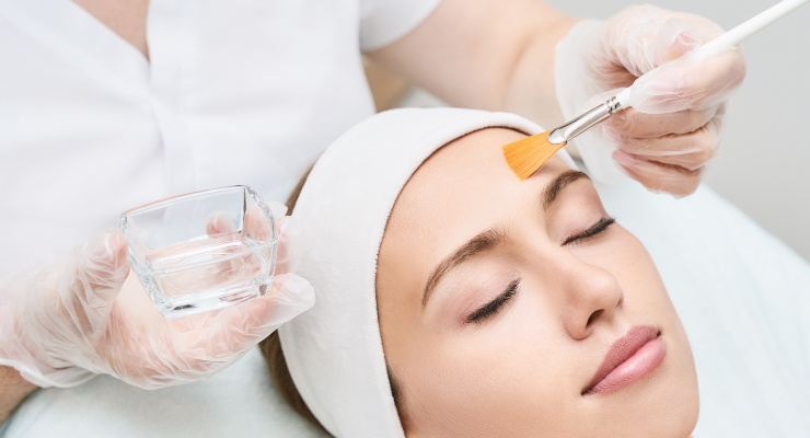 Chemical peel treatment