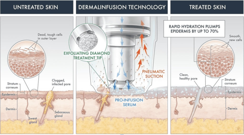 DiamondGlow facial treatment