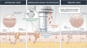 DiamondGlow facial treatment