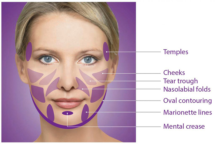 SKIN RESTRUCTURING WITH SCULPTRA INJECTABLE TREATMENT
