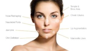 Dermal fillers injection Los Angeles