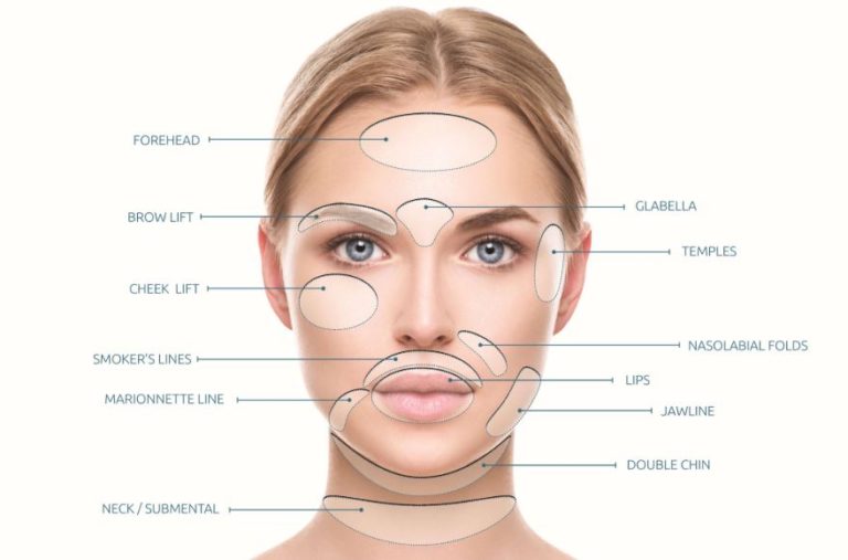 PDO thread lift skin threading los angeles