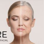 Put aging on hold with Vampire facial treatment