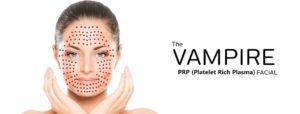 Vampire Facial in Los Angeles