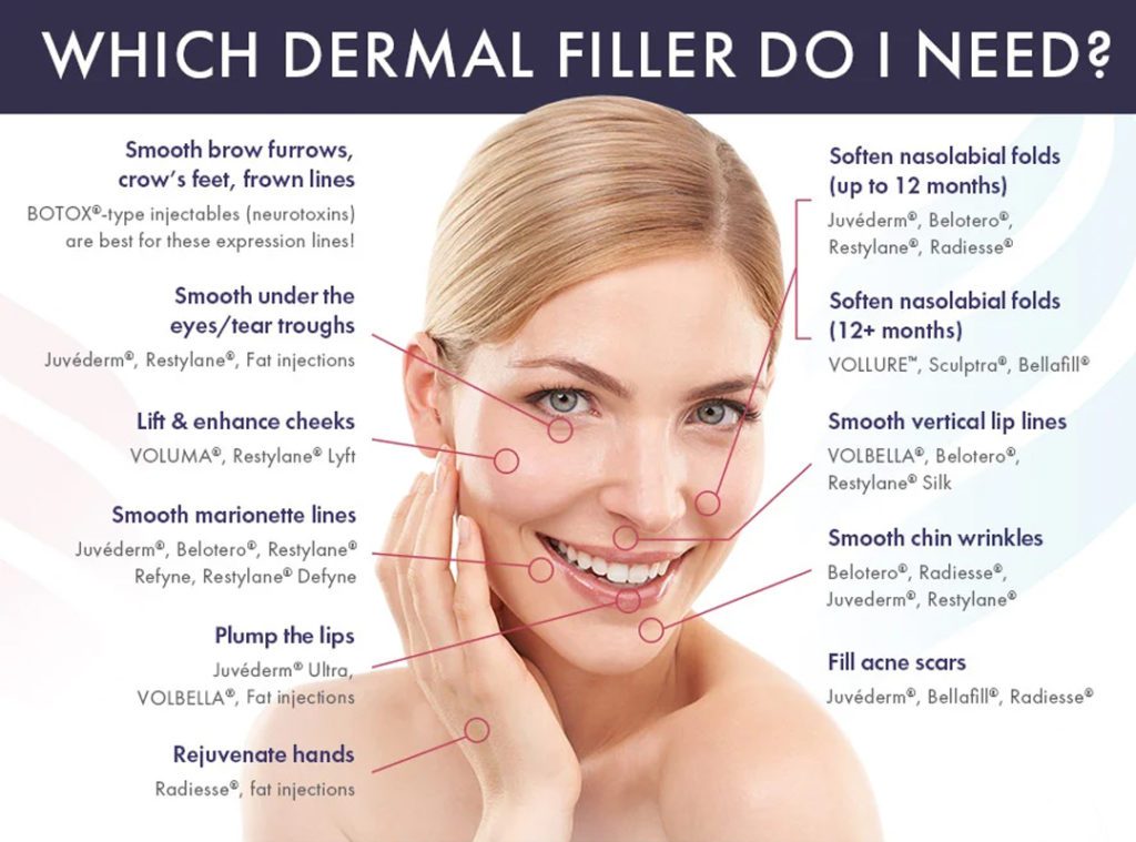 dermal filler injections in Los Angeles