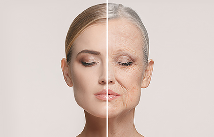 Put aging on hold with PRP Microneedling