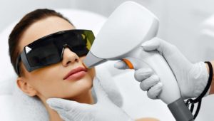 facial laser hair removal