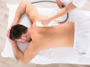 laser hair removal for men