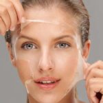 chemical skin peel Los Angeles