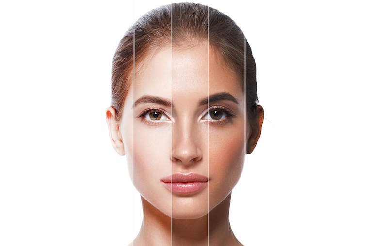 improve your skin with chemical peel Los Angeles