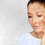 lumecca ipl treatment for skin rejuvenation Los Angeles