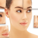 How to treat skin pigmentatio