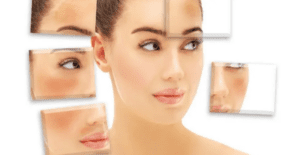 How to treat skin pigmentatio