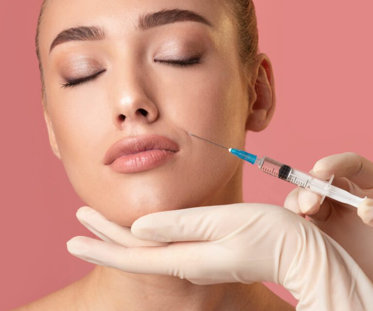 facial lines removal via dermal fillers