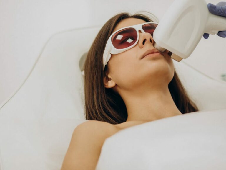 laser hair removal facial Los Angeles