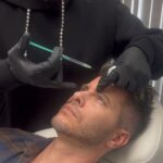 Men's botox Los Angeles