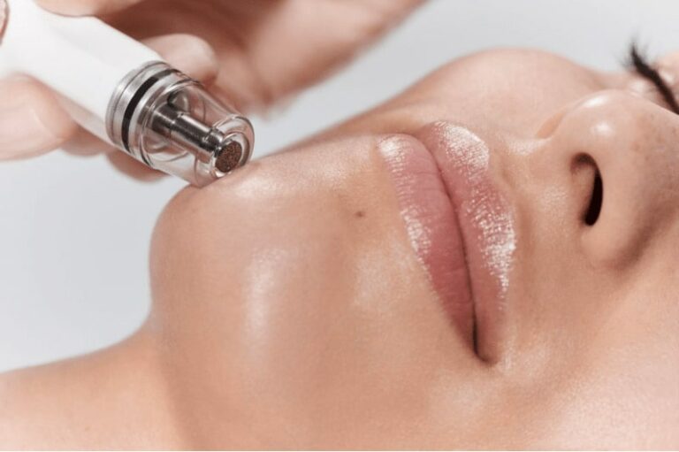 Diamond Glow treatment for winter skin care Los Angeles