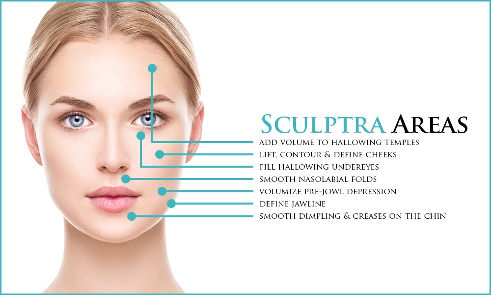 Sculptra areas Los Angeles