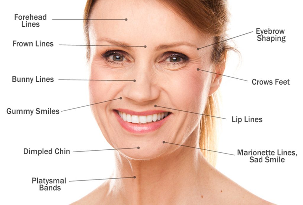 dermal fillers for facial contouring