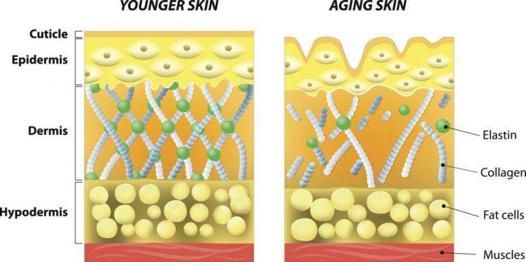 Morpheus8 treatment helps increase collagen production Los Angeles