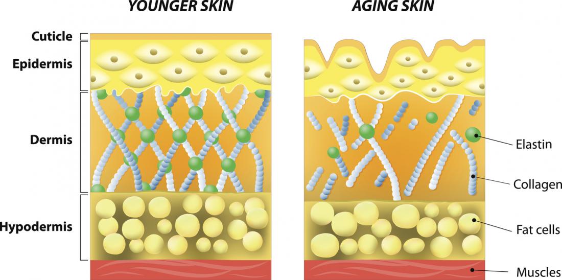 Morpheus8 treatment helps increase collagen production Los Angeles