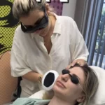 IPL treatment on face Los Angeles