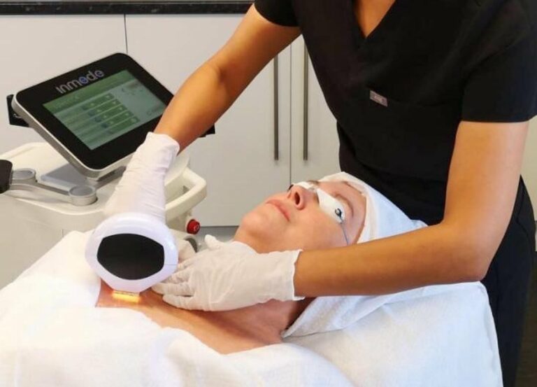 Photorejuvenation via Lumecc IPL for pigmentation treatment in Los Angeles