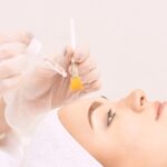 spring clean your skin with chemical peels