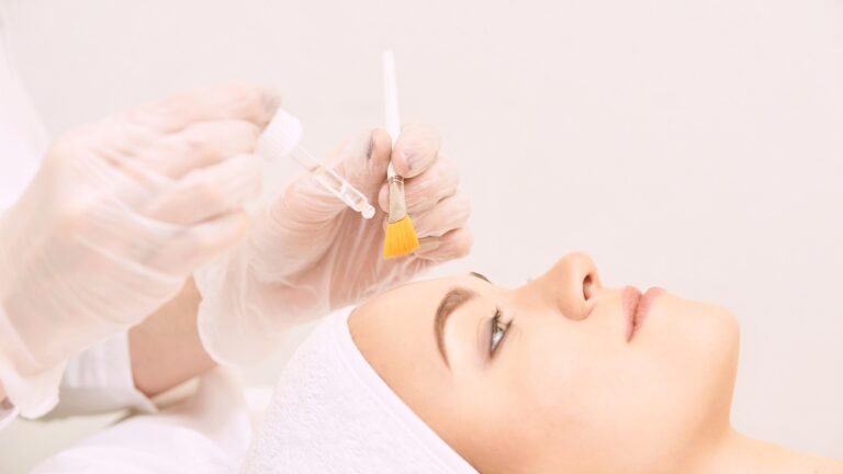 spring clean your skin with chemical peels