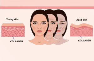 Collagen presentation in young and aged skin
