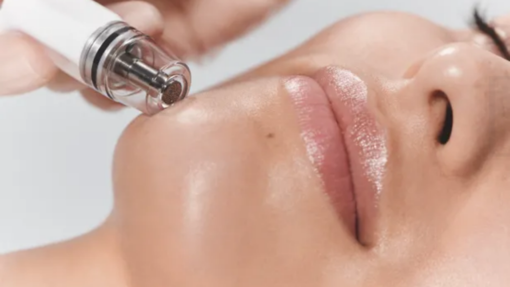 DiamondGlow facial for Summer Skincare Los Angeles