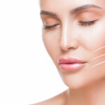 cheek wrinkles treatment with Sculptra Los Angeles