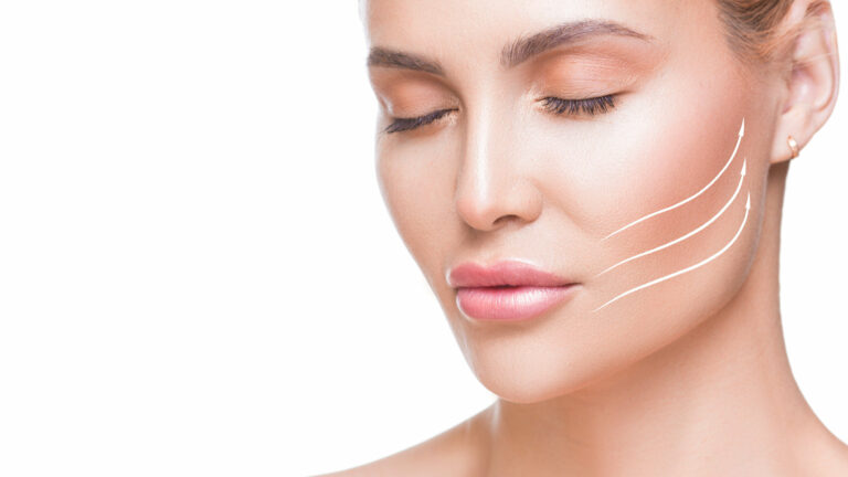 cheek wrinkles treatment with Sculptra Los Angeles
