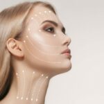 Facial contouring Los Angeles