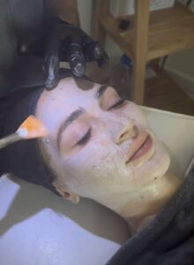 diamondglow facial treatment los angeles