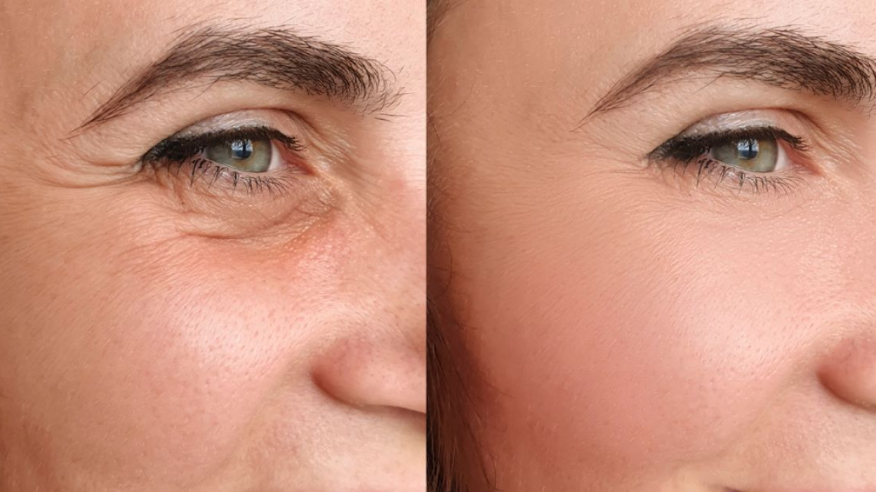 daxxify anti-wrinkles treatment Los Angeles