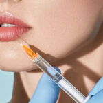 dermal lip filler Los Angeles