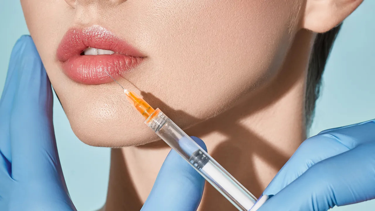 dermal lip filler Los Angeles