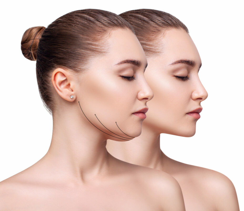 skin tightening treatments Los Angeles