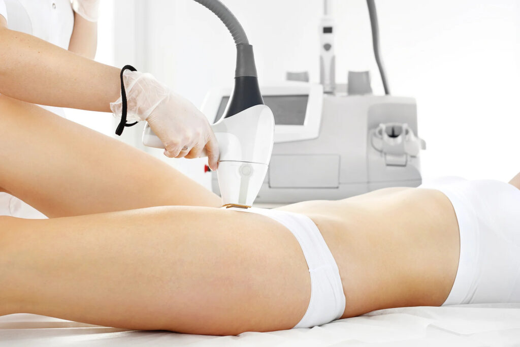 benefits of laser hair removal treatment Los Angeles