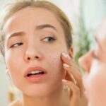 get rid of dry skin with effective treatments Los Angeles