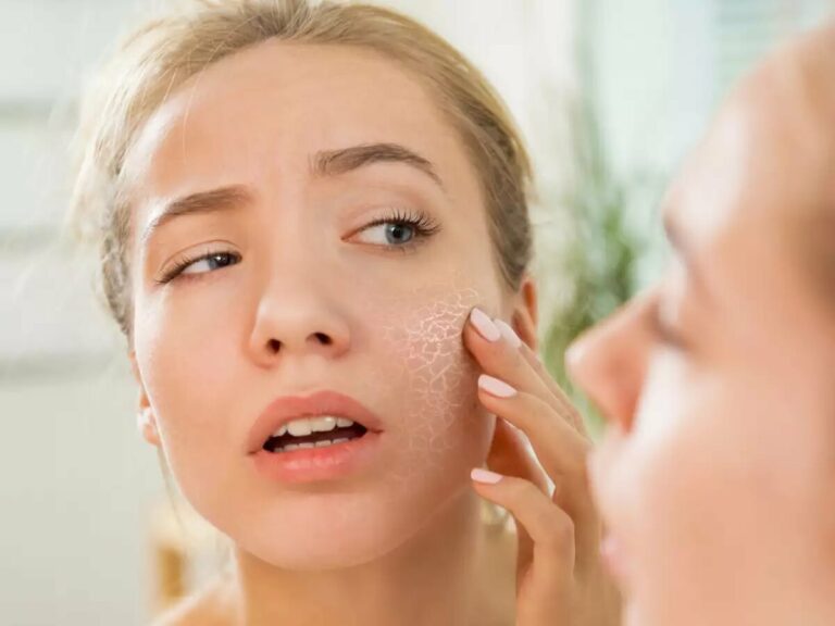 get rid of dry skin with effective treatments Los Angeles