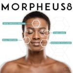 Morpheus 8 for skin rejuvenation Los Angeles