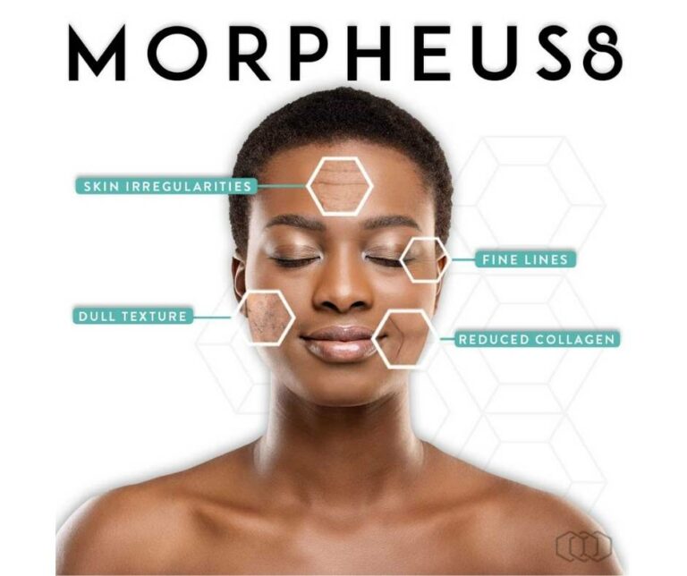 Morpheus 8 for skin rejuvenation Los Angeles