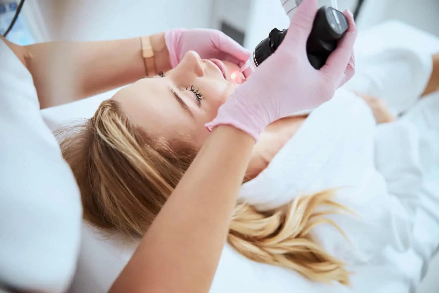 CO2 laser resurfacing Los Angeles