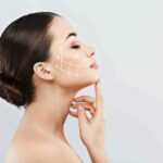The top choice for non-surgical cheek lift Los Angeles